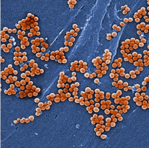 Genome Res：全基因组测序追踪耐药细菌传播机制